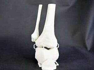 FDM Printed PLA Patella Model as Surgical Guide
