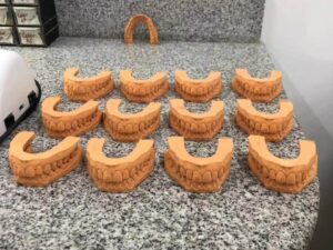 DLP 3D Printed Dental Teeth Model For Display